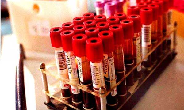 L’oncologo Enzo Iervolino: «Donare il sangue aiuta anche la ricerca»