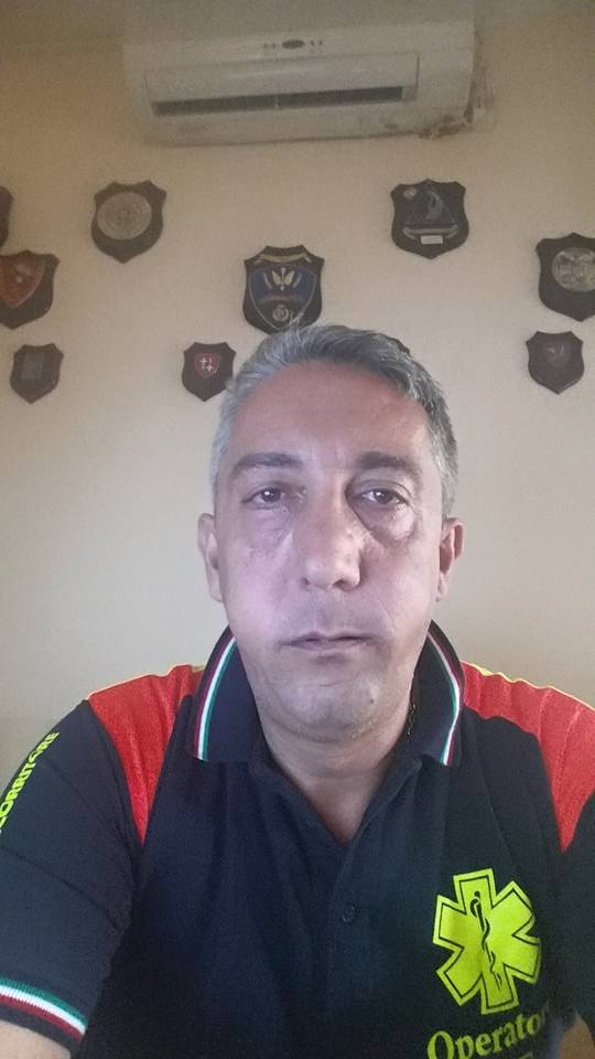 Ambulanze della camorra, Erminio Battocchio gonfiato da ignoti