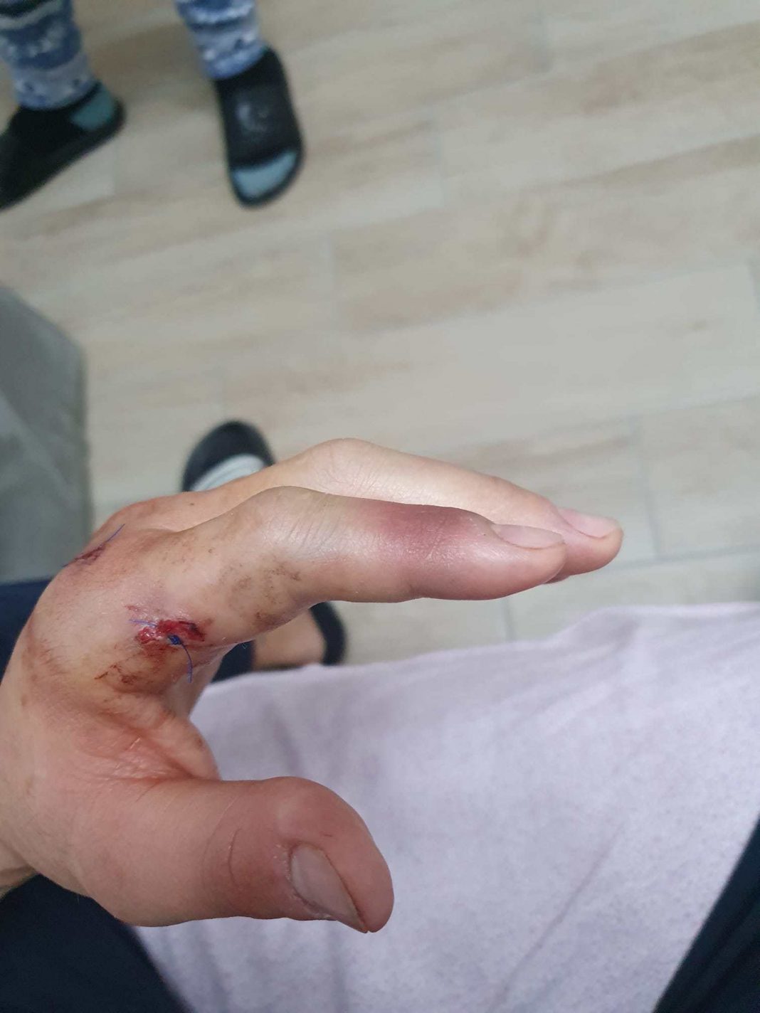 Ferito con proiettile dopo lite, condannato giovane pistolero. La vittima: “Spero in giustizia”