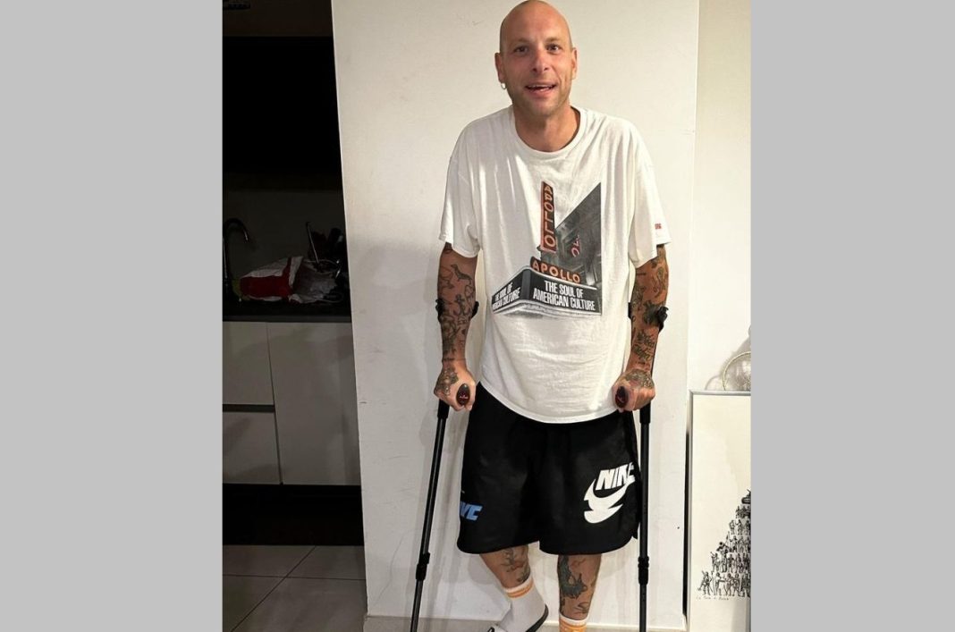 Clementino, infortunio sul palco: come sta ora il rapper di Cimitile