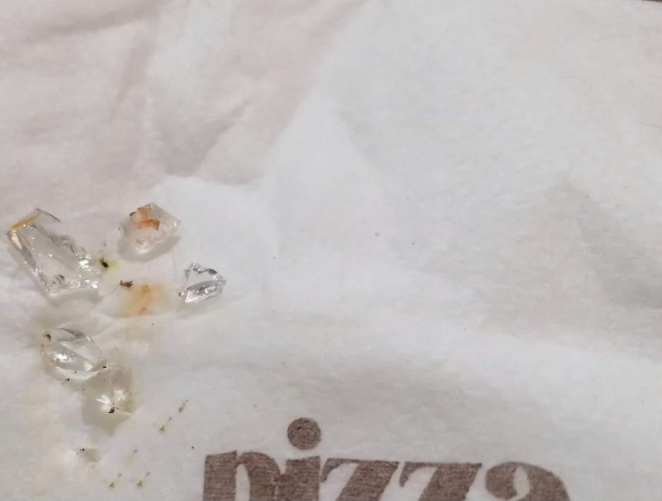 Festeggia compleanno in pizzeria, trova vetro nell’impasto: 19enne in ospedale