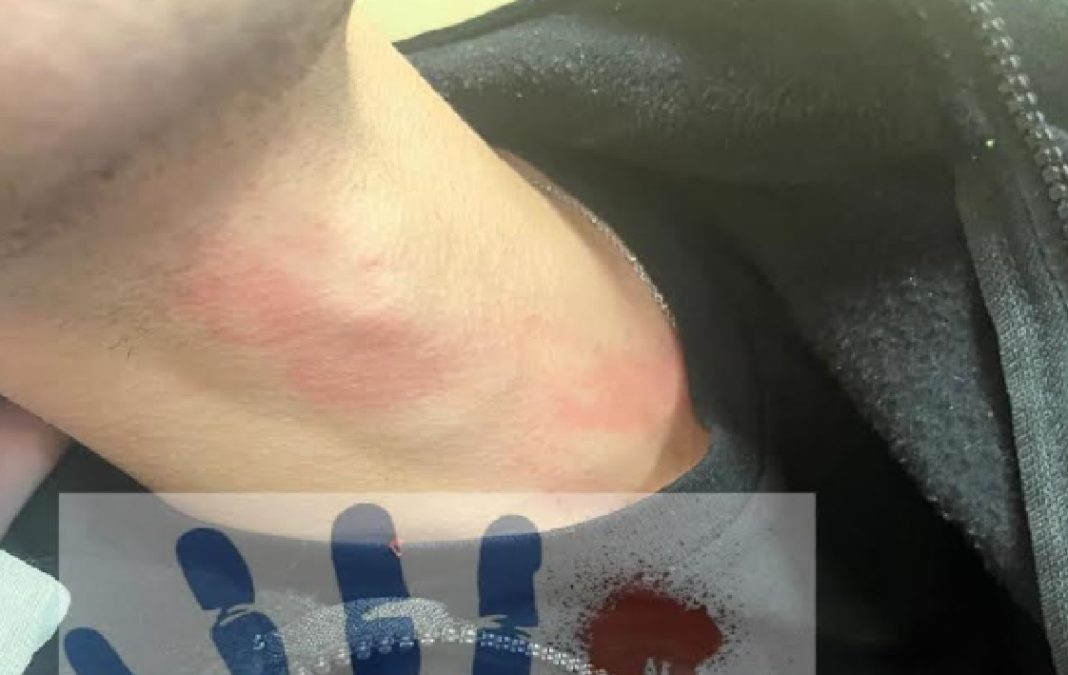 Follia all’ospedale: Oss prende a pugni l’infermiere