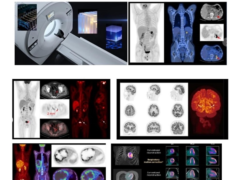 Medicina Futura potenzia la diagnostica con la nuova PET/TAC di ultima generazione