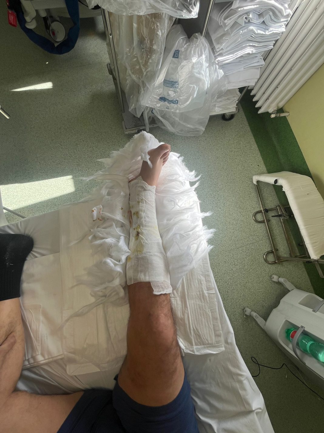 Autista investito da muletto costretto a casa da 4 mesi ma i responsabili sono irreperibili