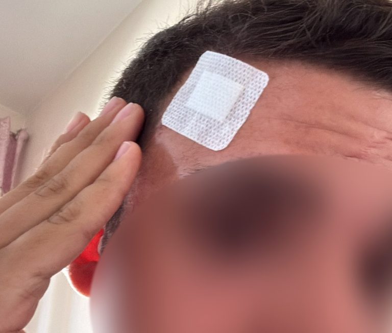 Ottaviano: ragazzo disabile preso a sassate da gruppo di minorenni