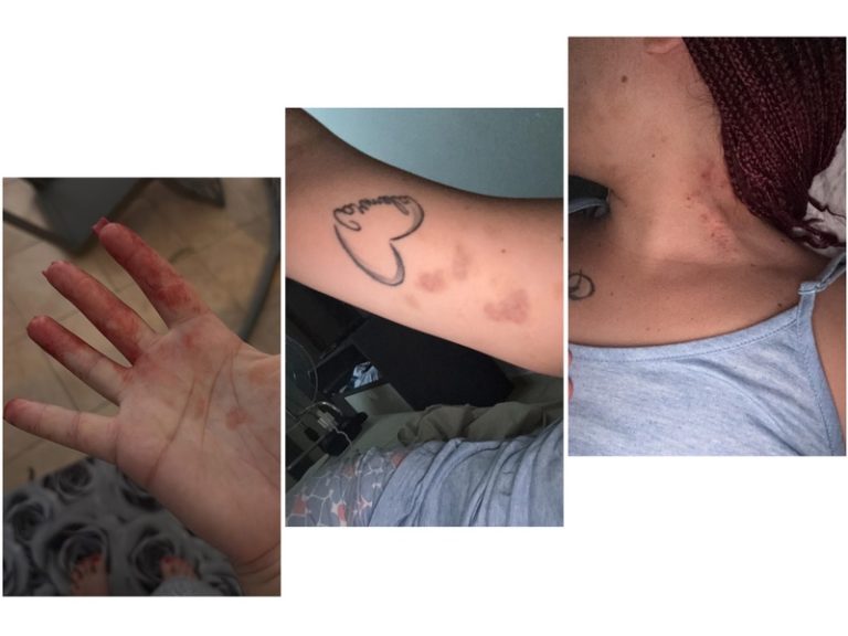 Brusciano, vittima di violenza domestica si salva grazie al supporto della figlia