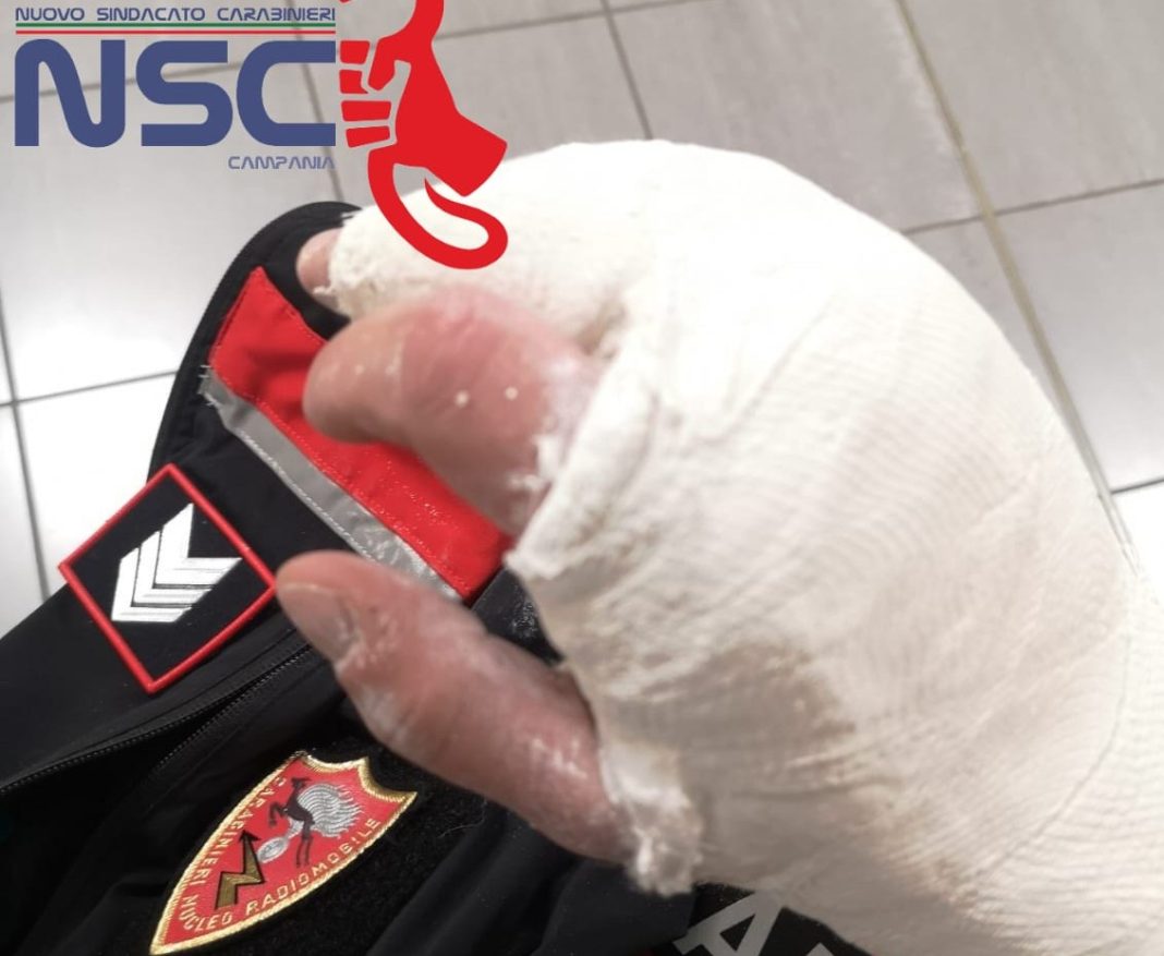 Tre carabinieri feriti a Cercola, NSC Campania: “L’uso sapiente del taser ha scongiurato una possibile tragedia”