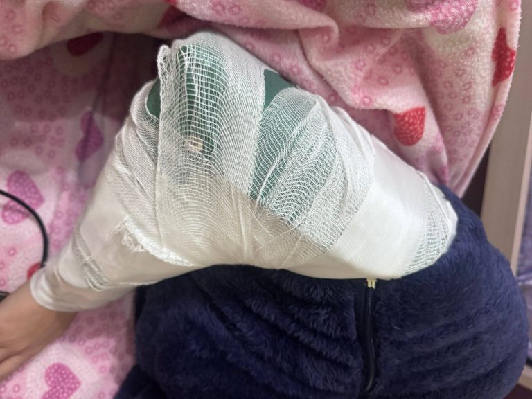 Marigliano: 15enne aggredita da coetanee, braccio fratturato e numero escoriazioni