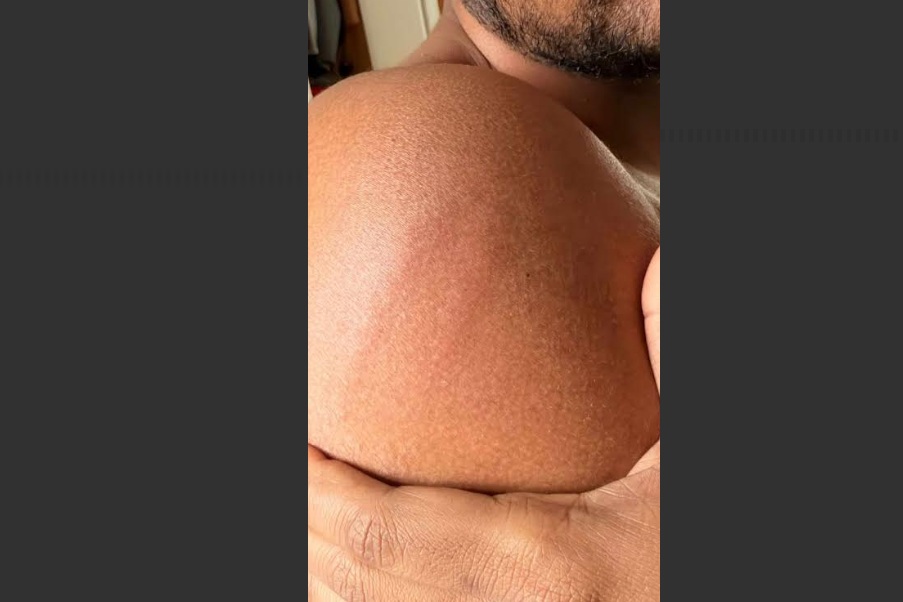 Ragazzi con Suv aggrediscono giovani bengalesi per il monopattino