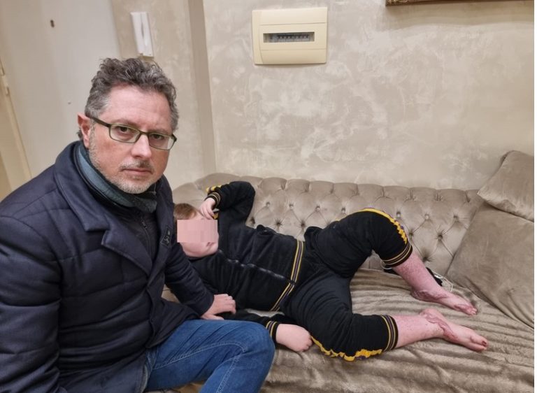 Sant’Anastasia, il dramma di Manuel ustionato a 12 anni: “Non può andare a scuola a 7 mesi dal rogo”