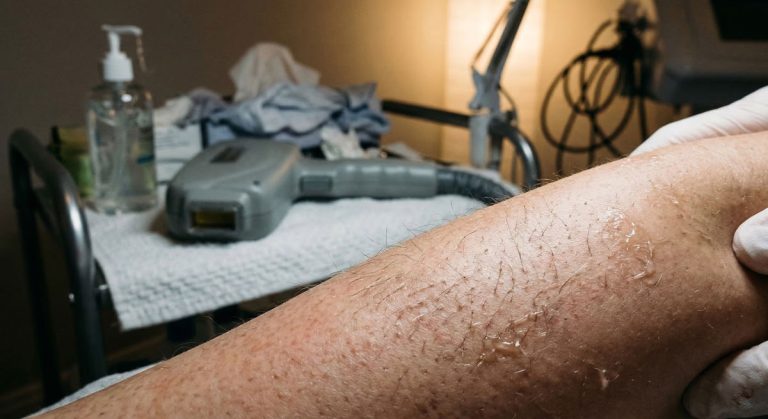 Il laser estetico e la trappola del Low-Cost: quando il risparmio svuota il tuo centro