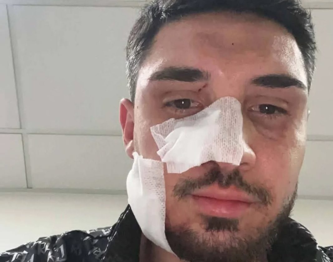 Incubo rapine sull’Asse Mediano: scende dall’auto e viene aggredito